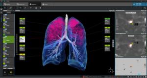 Coreline Soft Establishes Itself as a Leader in AI Medical Imaging Research