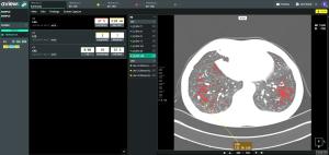 Coreline Soft Accelerates Global Growth with European Partnership and US Market Expansion